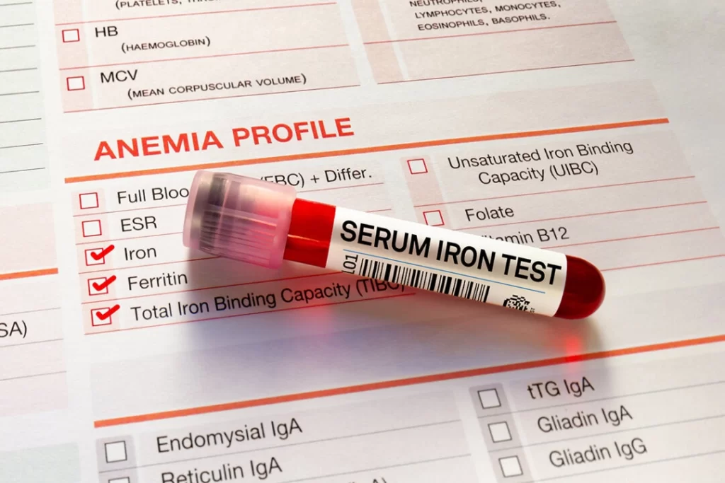 anemia-dr-jose-nasser