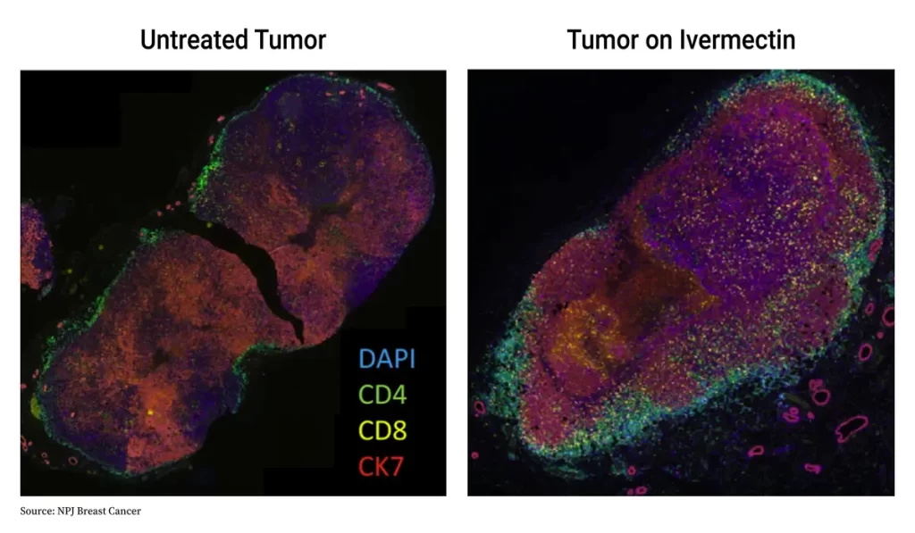cancer-cell-dr-jose-nasser-aquera
