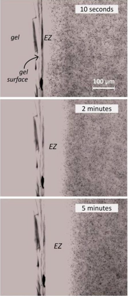 microesferas-ezwater-dr-jose-nasser-aquera
