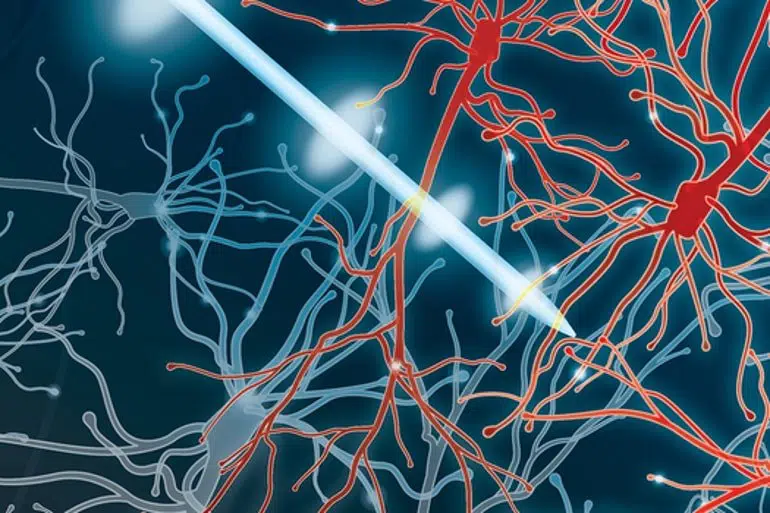 precise-dbs-parkinsons-neurosnces-dr-jose-nasser-aquera.jpg